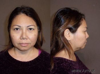 Thu Trang Thi Nguyen Mugshot