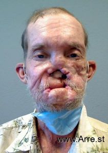 David Arvesen Arrest Mugshot
