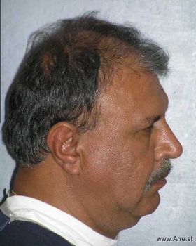 Rakesh K Manhindru Mugshot