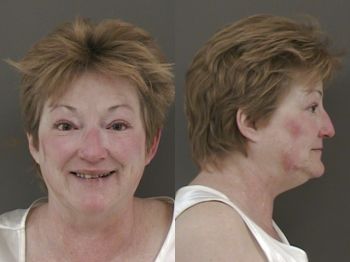 Nancy  Edelman Mugshot